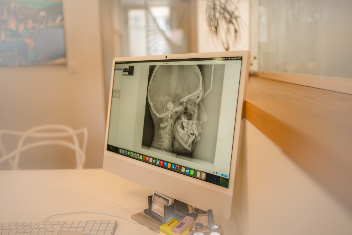 Radiographie 2D